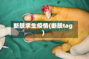 断肢求生疫情(断肢tag)