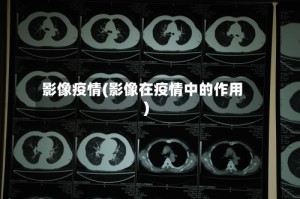 影像疫情(影像在疫情中的作用)