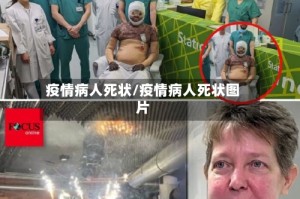 疫情病人死状/疫情病人死状图片