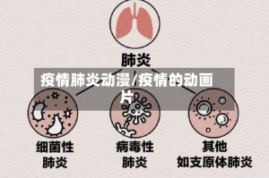 疫情肺炎动漫/疫情的动画片