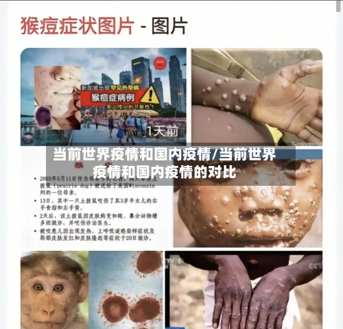 当前世界疫情和国内疫情/当前世界疫情和国内疫情的对比-第1张图片