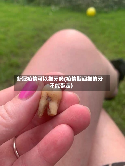 新冠疫情可以拔牙吗(疫情期间拔的牙不能带走)-第1张图片